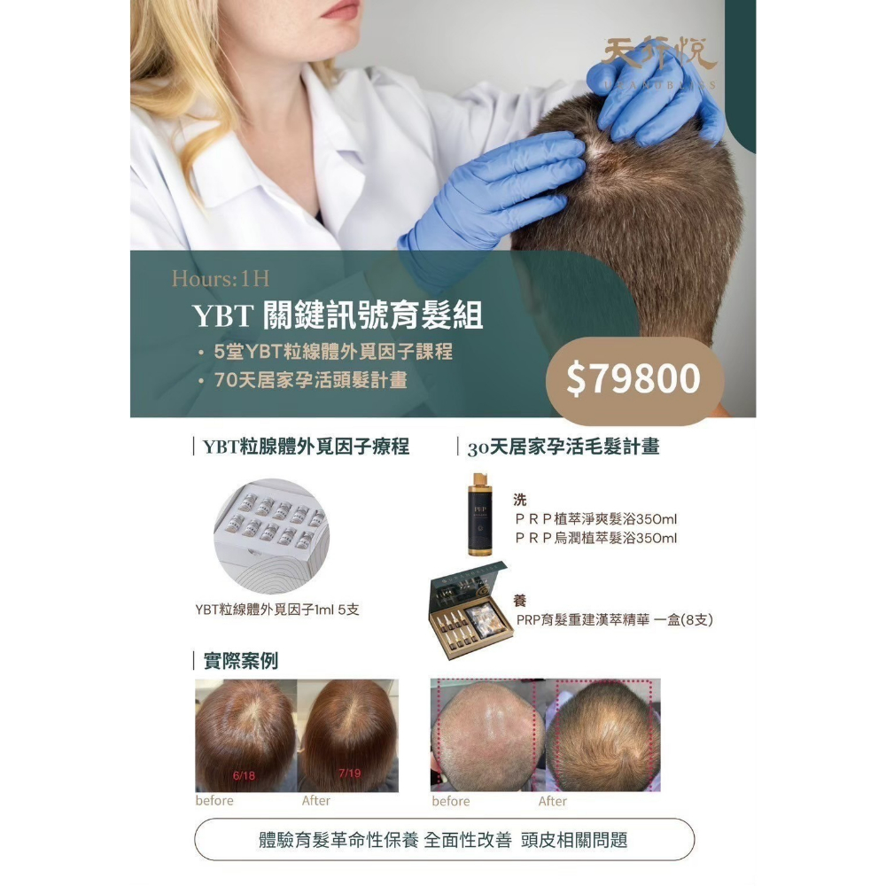 YBT關鍵訊號育髮組