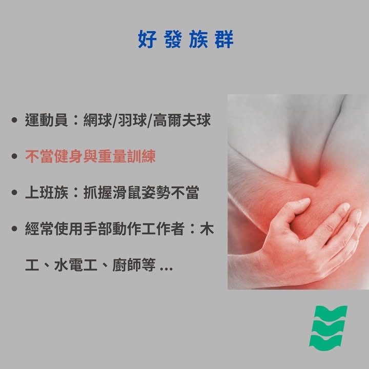 什麼是網球肘(肱骨外上髁炎)