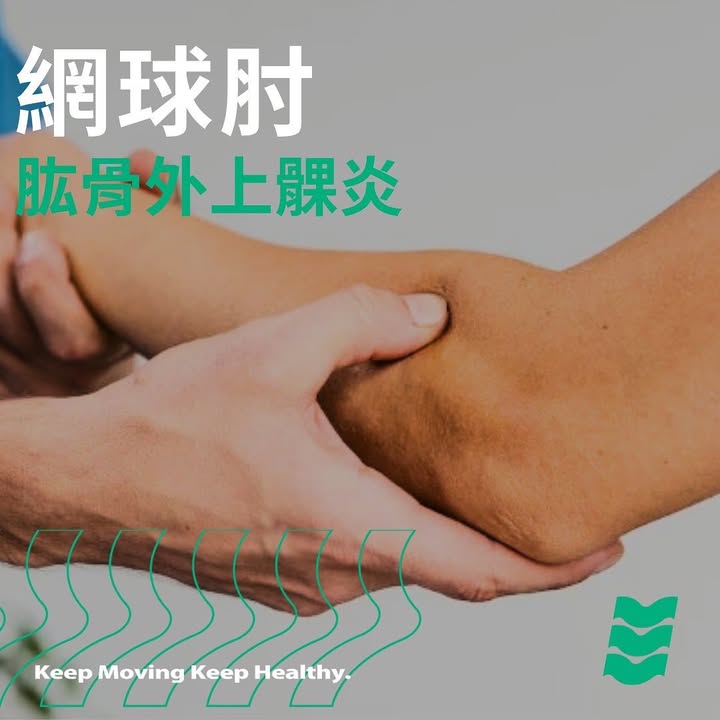 什麼是網球肘(肱骨外