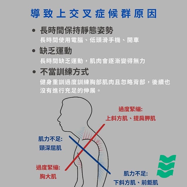 上交叉症候群