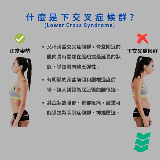下交叉症候群