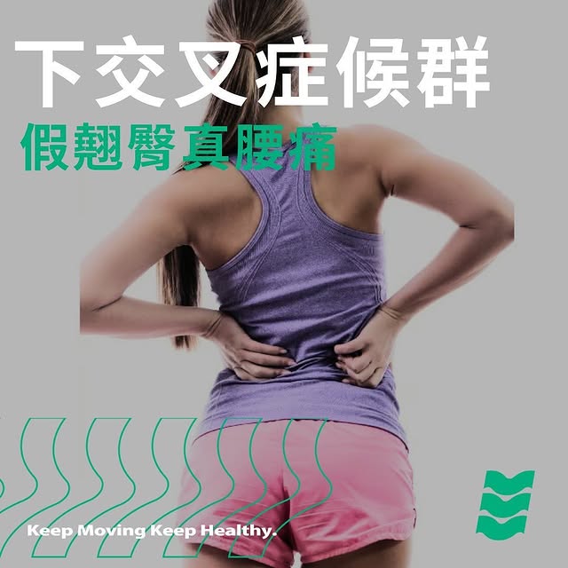 下交叉症候群