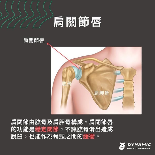 班卡式病變(前下關節唇撕裂)