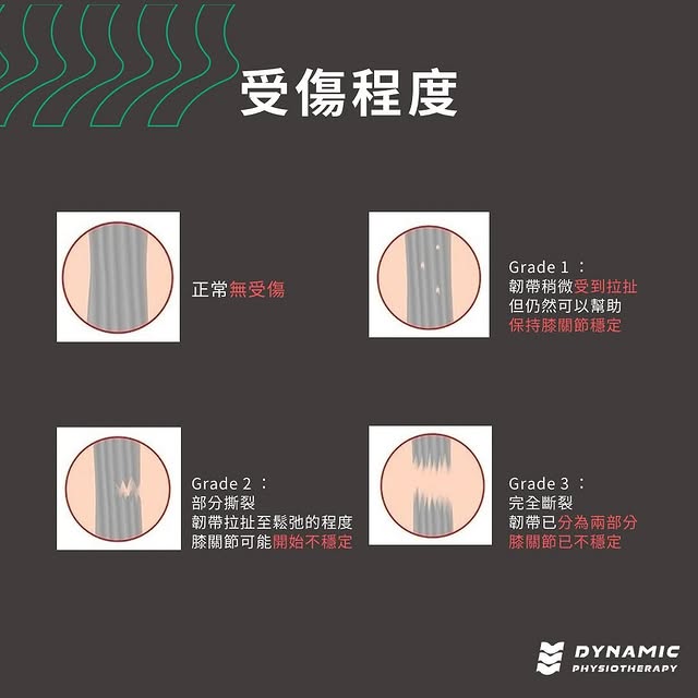 前十字韌帶損傷-運動員的噩夢