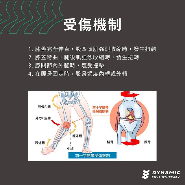 前十字韌帶損傷-運動員的噩夢