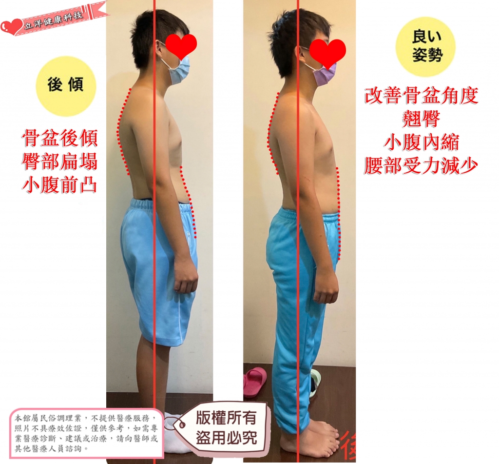兒童體態矯正