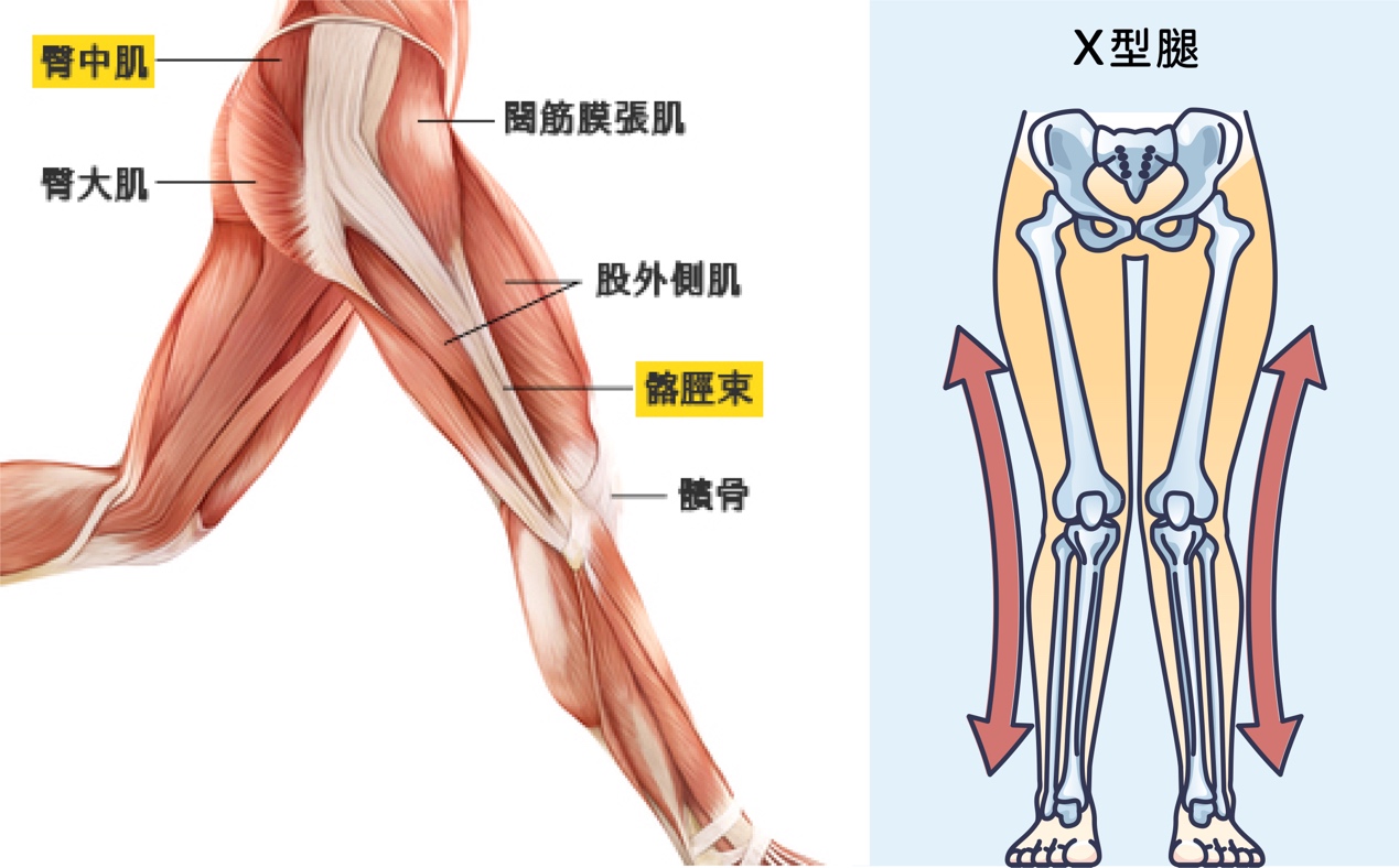 髂脛束、臀中肌位置與扁平足X型腿 示意圖