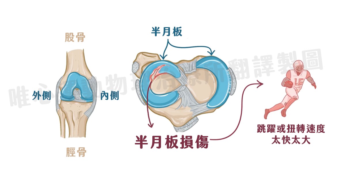 (圖片來源：osmosis.org。 唯心運動物理治療所 翻譯製圖)