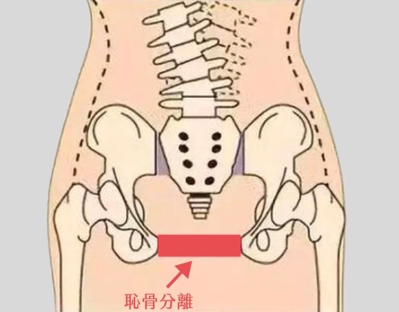 (圖片來源：唯心運動物理治療所)