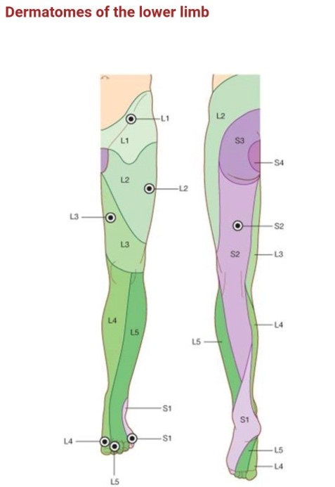 壓迫神經越多時，影響範圍越遠(圖片來源: dermatomemap.com)