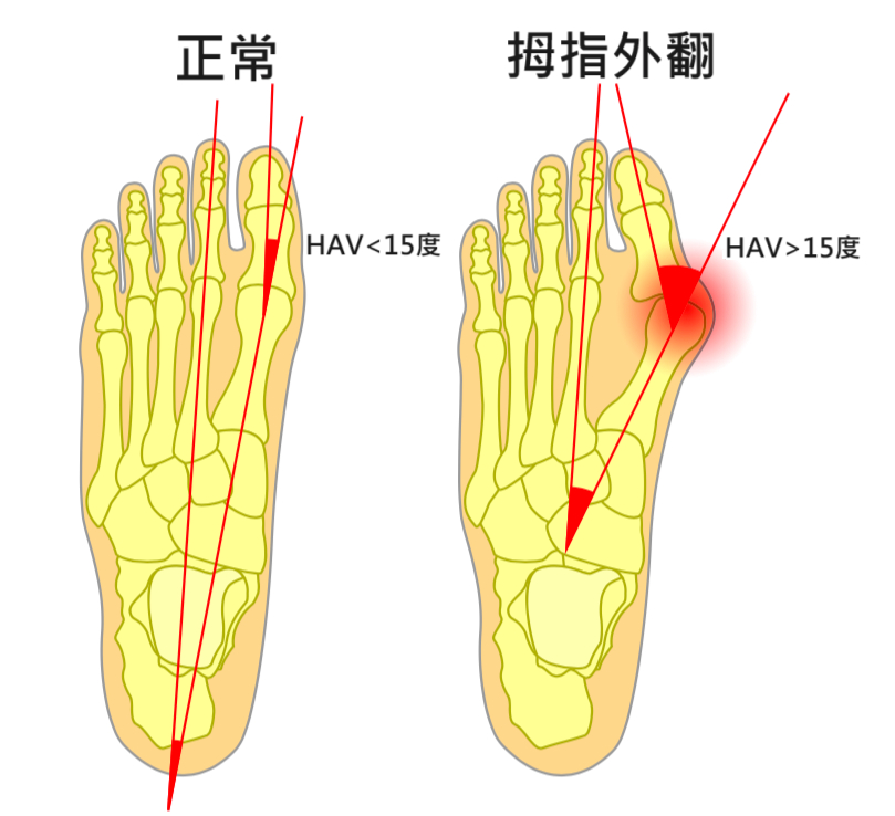 (圖片製作: 唯心運動物理治療所)