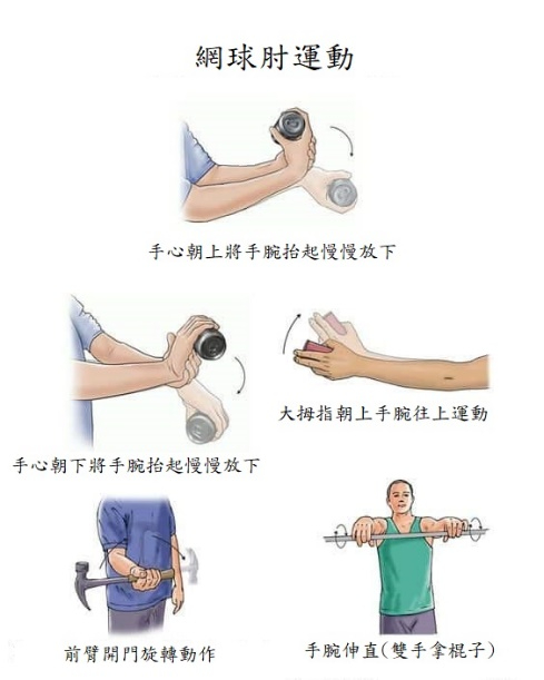 (圖片製作： 唯心運動物理治療所)