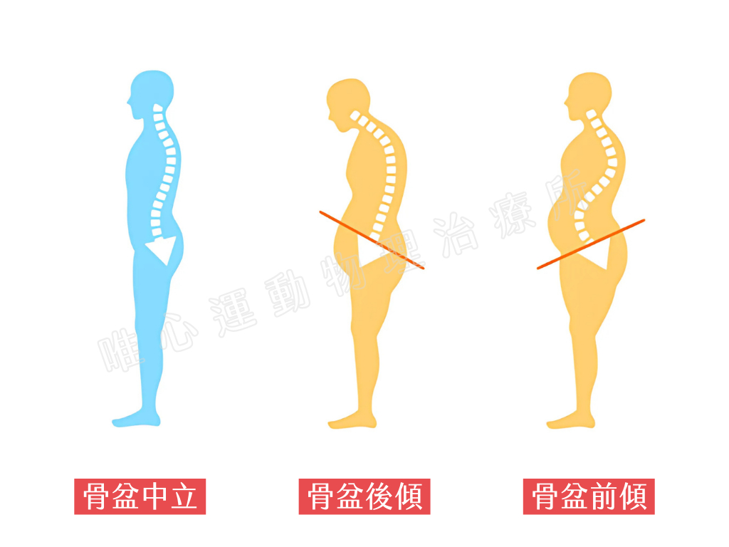 (圖片製作： 唯心運動物理治療所)