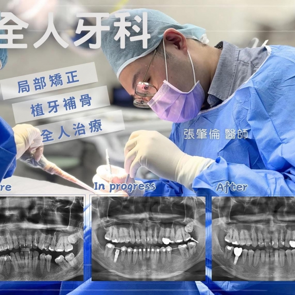 全人牙科|局部矯正|