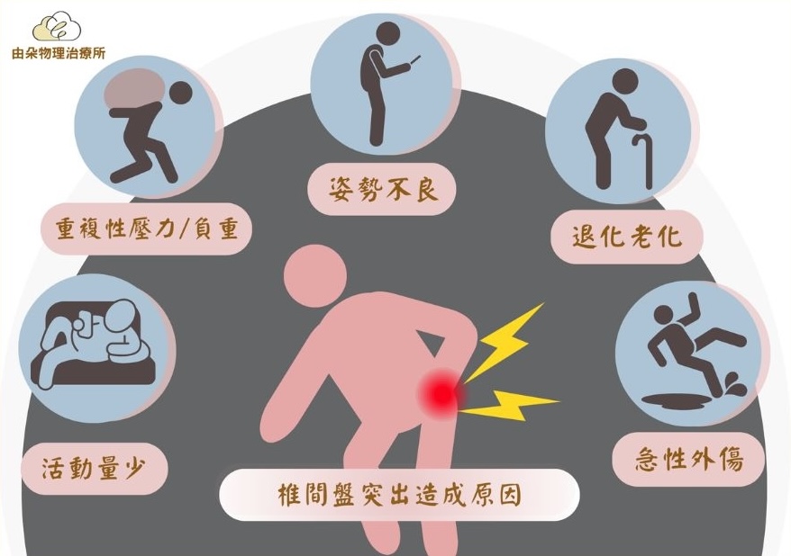 椎間盤突出 | 腰部劇烈疼痛｜下肢無力感｜坐骨神經痛｜腳麻